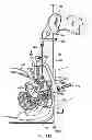 Fig. 90 - Systems, devices and methods for minimally invasive pelvic surgery