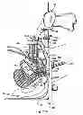 Fig. 92 - Systems, devices and methods for minimally invasive pelvic surgery