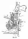 Fig. 94 - Systems, devices and methods for minimally invasive pelvic surgery