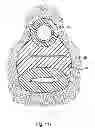 Fig. 95 - Systems, devices and methods for minimally invasive pelvic surgery