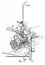 Fig. 96 - Systems, devices and methods for minimally invasive pelvic surgery