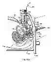 Fig. 97 - Systems, devices and methods for minimally invasive pelvic surgery