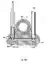 Fig. 99 - Systems, devices and methods for minimally invasive pelvic surgery