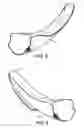 Fig. 04 - Guiding device for use with laryngoscope