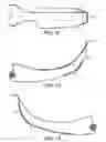 Fig. 07 - Guiding device for use with laryngoscope
