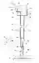 Fig. 01 - Remote traction and guidance system for mini-invasive surgery