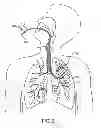 Fig. 03 - Methods and systems for endobronchial diagnostics
