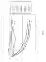 Fig. 08 - HUMAN TISSUE RADIATION PROTECTOR WITH AUXILIARY METHOD OF RADIOTHERAPY
