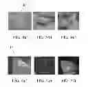 Fig. 09 - HUMAN TISSUE RADIATION PROTECTOR WITH AUXILIARY METHOD OF RADIOTHERAPY