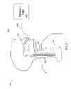 Fig. 04 - ANALYSIS AND VISUALIZATION METHODS USING MANOMETRY DATA