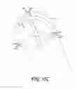 Fig. 24 - SOFT TISSUE CORING BIOPSY DEVICES AND METHODS