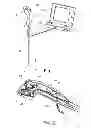 Fig. 02 - Operating device with a control handle and a flexible element connected to the control handle