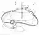 Fig. 01 - Non-surgical torso deformity correction devices and methods related thereto