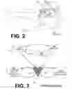 Fig. 03 - CPR chest compression machine performing prolonged chest compression