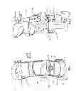 Fig. 02 - Orthopedic device having a dynamic control system and method for using the same