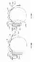 Fig. 11 - Orthopedic device having a dynamic control system and method for using the same