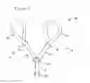 Fig. 02 - Posture correction reminder
