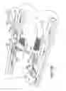 Fig. 04 - Arteriovenous access valve system and process