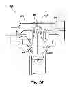 Fig. 09 - System for surgical insufflation and gas recirculation