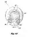 Fig. 11 - System for surgical insufflation and gas recirculation