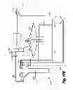 Fig. 14 - System for surgical insufflation and gas recirculation