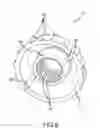 Fig. 07 - Steering actuator for deflectable catheter
