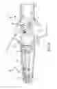 Fig. 09 - Steering actuator for deflectable catheter