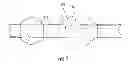 Fig. 05 - Double balloon catheter
