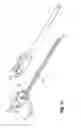 Fig. 04 - CATHETER WITH REMOVABLE CANNULA FOR PUNCTURING A BODY CAVITY AND CANNULA FOR THE USE WITH A CATHETER WHICH CAN BE MOVED IN THE CANNULA