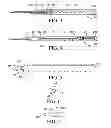 Fig. 03 - Retractable needle catheter insertion device