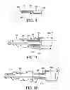 Fig. 04 - Retractable needle catheter insertion device