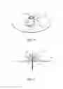 Fig. 05 - Catheter assembly