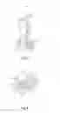 Fig. 06 - Catheter assembly
