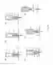 Fig. 13 - Catheter assembly