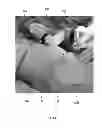 Fig. 02 - Method for Obtaining Sterile Human Amniotic Fluid and Uses Thereof
