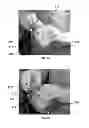 Fig. 06 - Method for Obtaining Sterile Human Amniotic Fluid and Uses Thereof