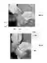 Fig. 07 - Method for Obtaining Sterile Human Amniotic Fluid and Uses Thereof