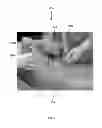 Fig. 08 - Method for Obtaining Sterile Human Amniotic Fluid and Uses Thereof