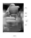 Fig. 09 - Method for Obtaining Sterile Human Amniotic Fluid and Uses Thereof
