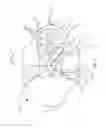 Fig. 09 - Absorbent article with dual core