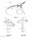 Fig. 02 - INFLATABLE SYSTEM FOR ENTERAL FEEDING DEVICE
