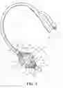 Fig. 03 - Retention drainage catheter