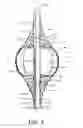 Fig. 04 - Retention drainage catheter