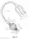 Fig. 08 - Retention drainage catheter