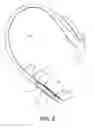 Fig. 09 - Retention drainage catheter