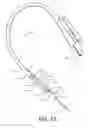 Fig. 12 - Retention drainage catheter
