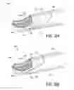 Fig. 09 - Tissue resecting devices and methods