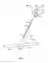 Fig. 09 - Spinal implant, instrument for preparation and method of use