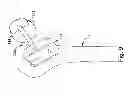 Fig. 06 - Positioning apparatus and method for a prosthetic implant