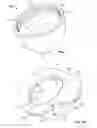 Fig. 02 - Patient-matched guides for orthopedic implants